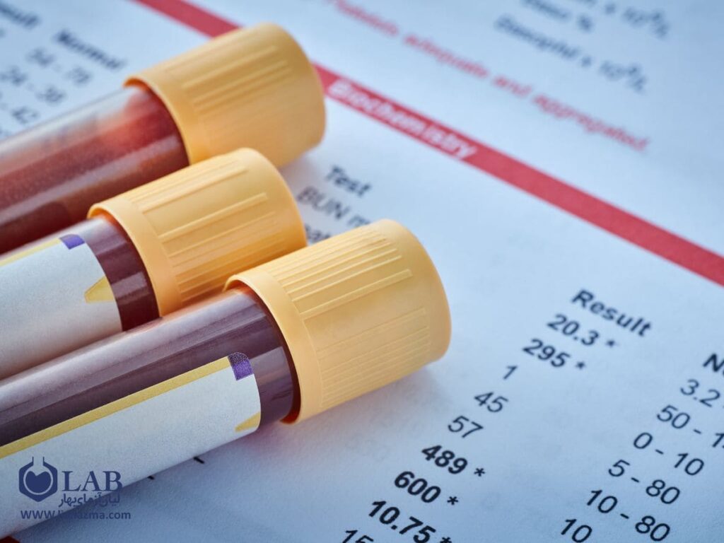 بررسی 5 مورد از انواع آزمایش خون و کاربردهای هر کدام
