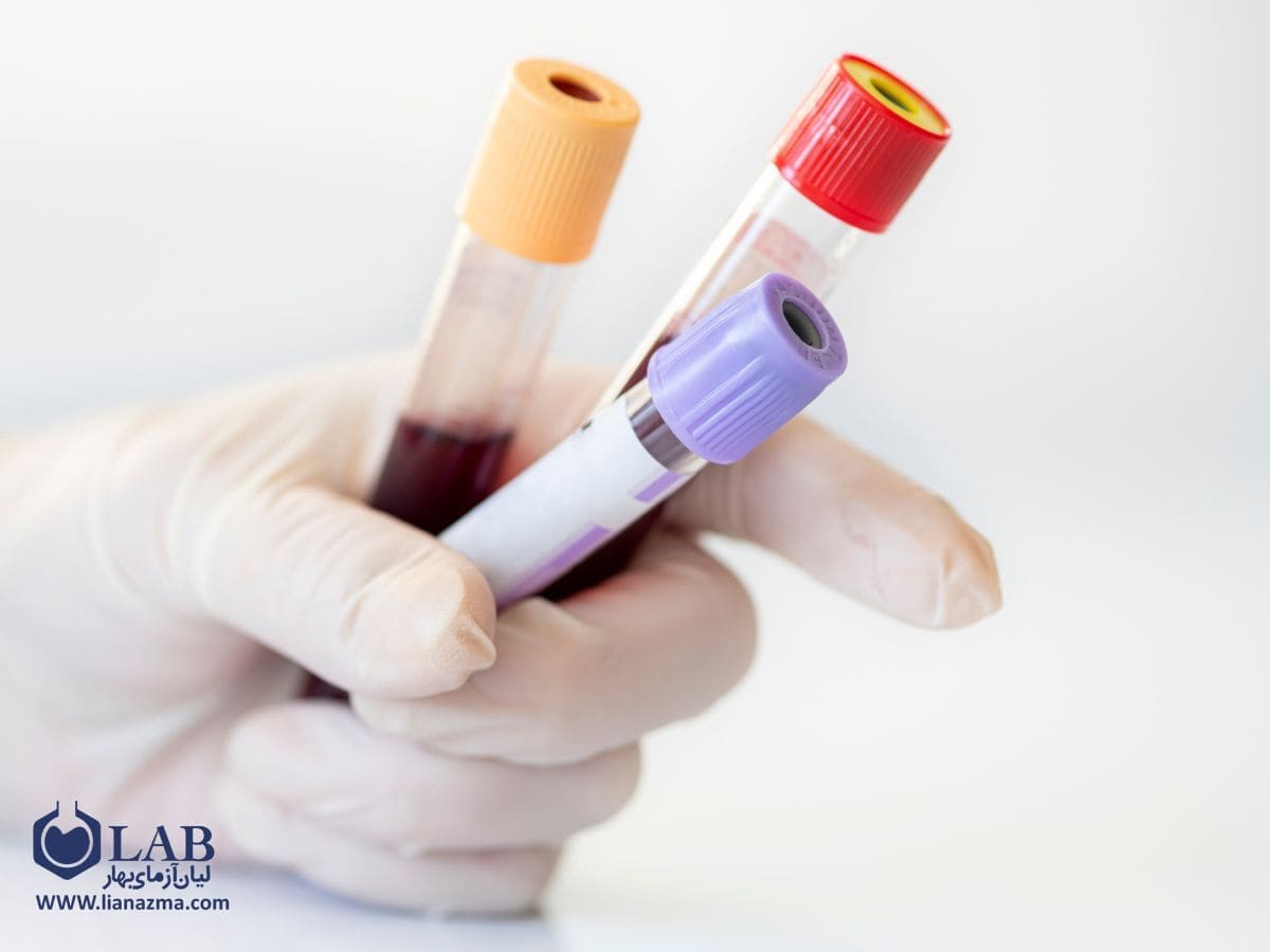 نکاتی که باید قبل از انجام انواع آزمایش های خون رعایت کنید