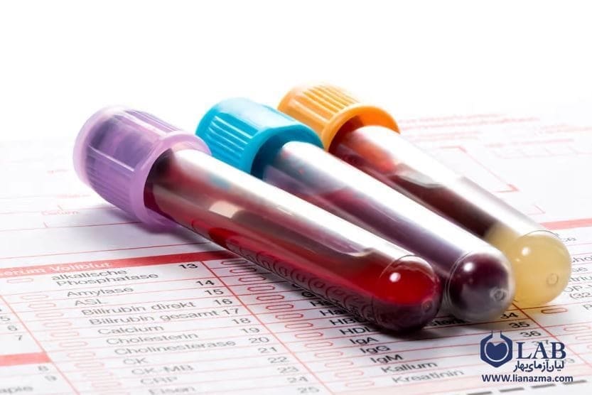 آزمایش سرطان از انواع آزمایشات خون