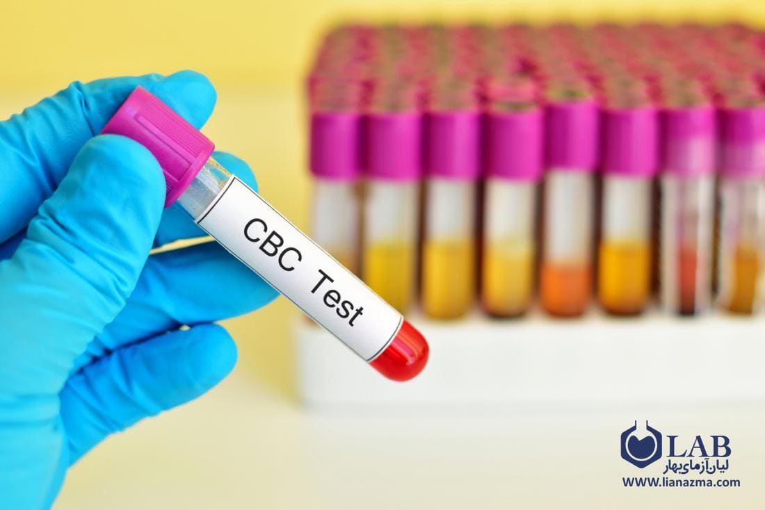 آزمایش شمارش کامل خون (CBC)