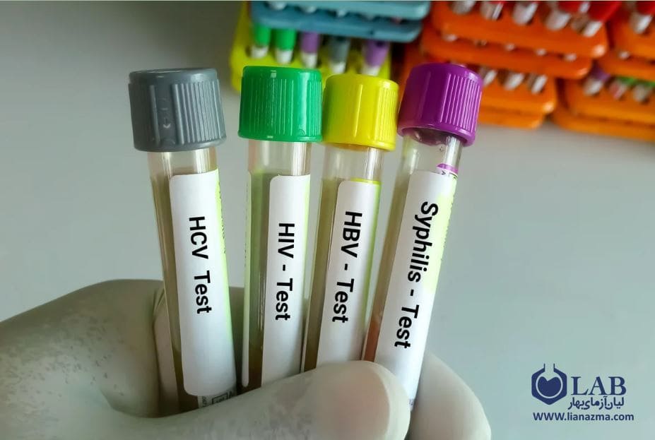 آزمایش عفونت‌های مقاربتی یکی از انواع آزمایش خون
