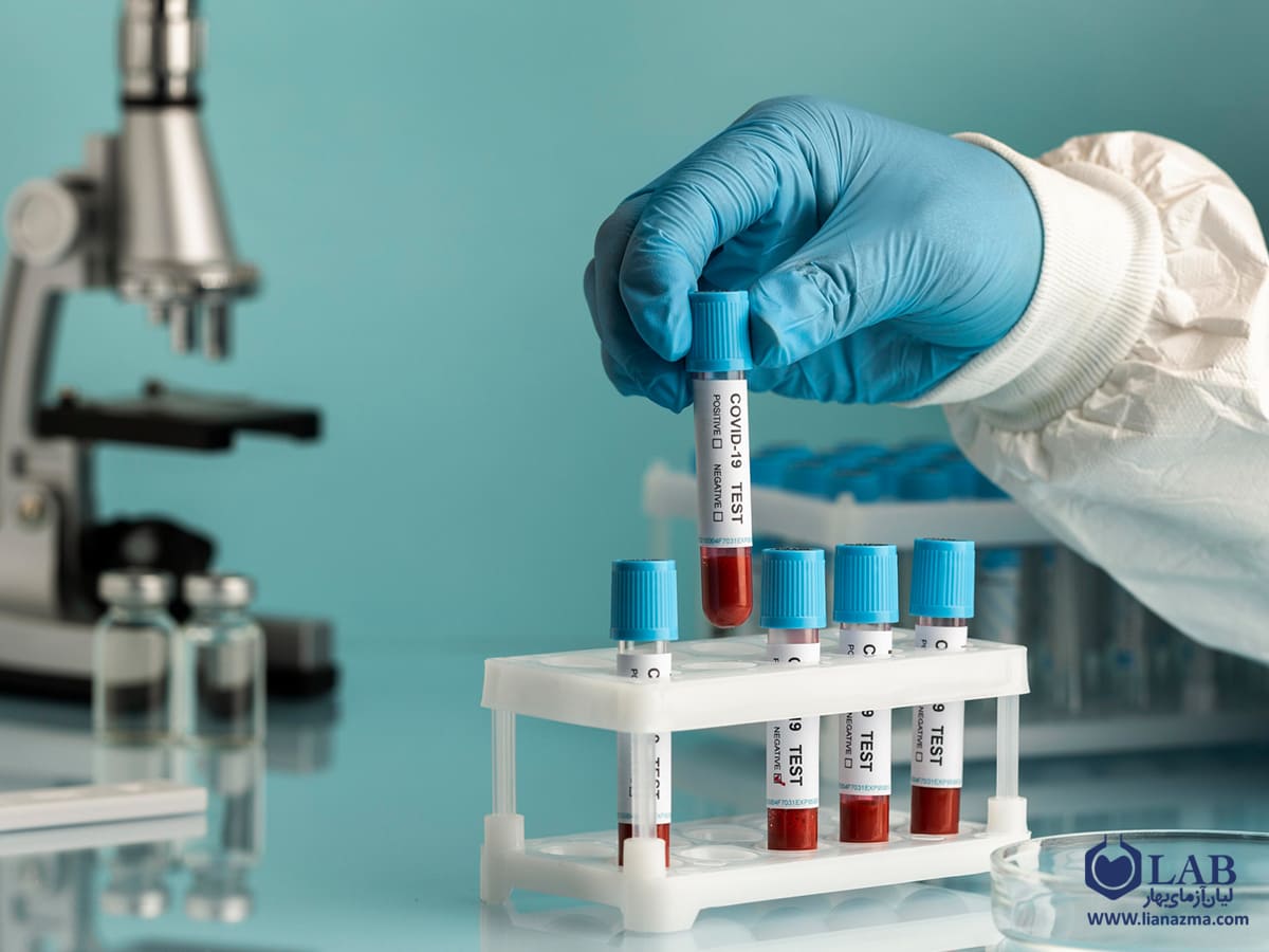 لوازم مصرفی در آزمایشگاه خون‌شناسی | لیان آزمای بهار