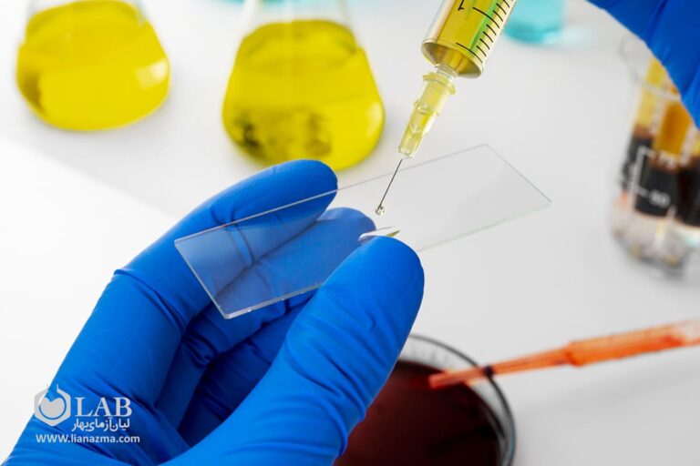 لام و لامل چیست و چه ویژگی هایی دارند؟ - لیان آزمای بهار