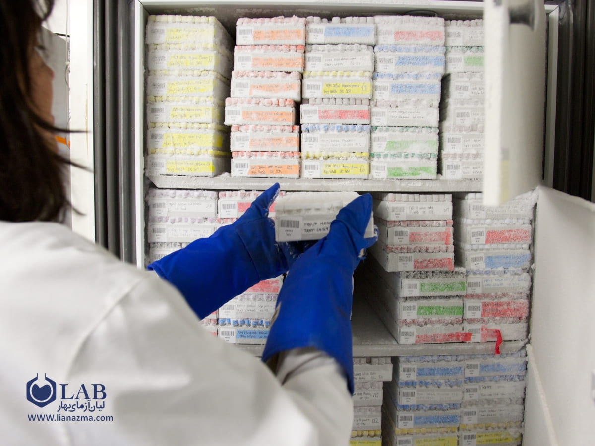 آموزش جامع نحوه کار با فریزر آزمایشگاهی | لیان آزمای بهار