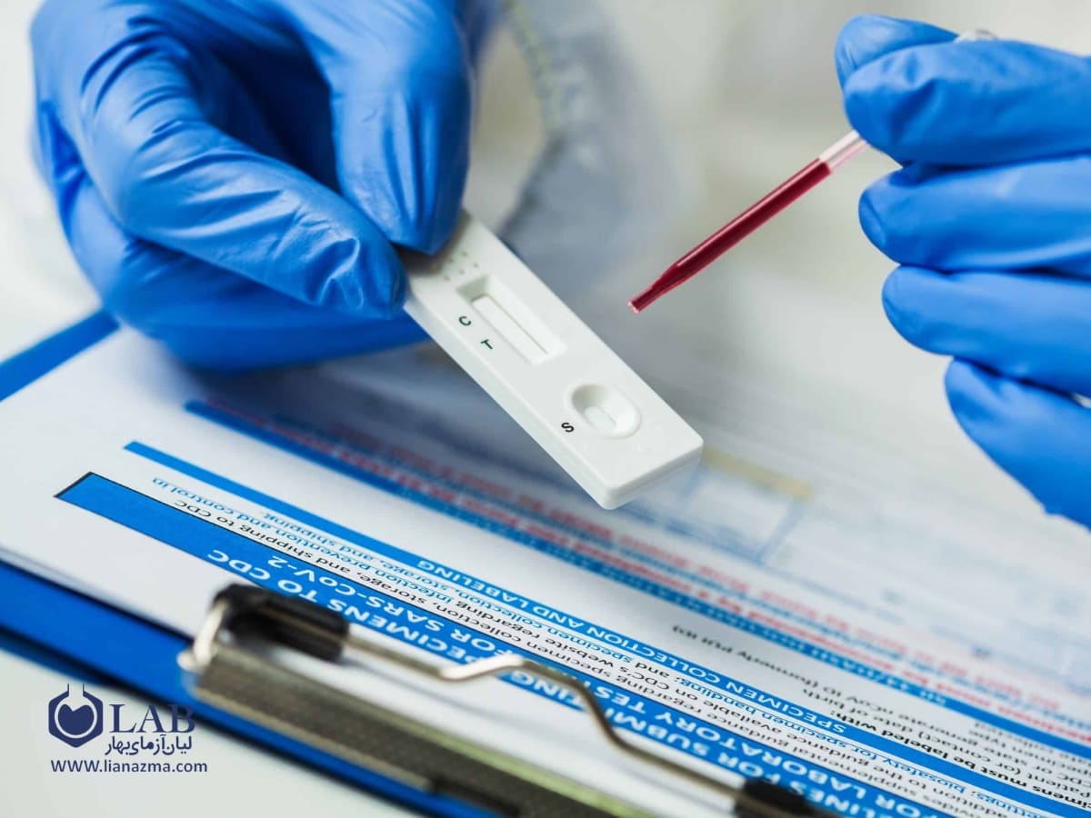 انواع کیت آزمایشگاهی بر اساس روش آزمایش | لیان آزمای بهار
