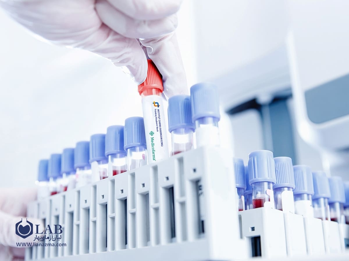 انواع کیت آزمایشگاهی بر اساس نوع نمونه | لیان آزمای بهار