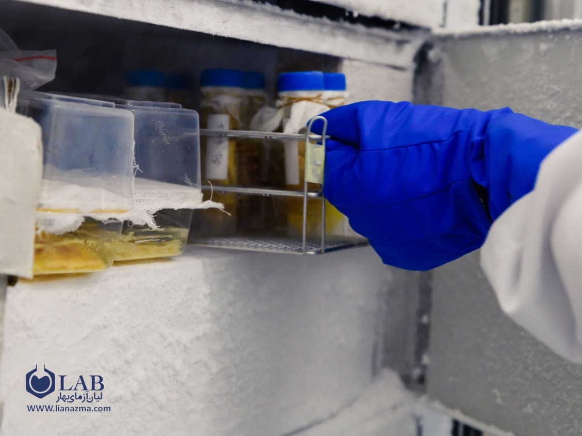 توجه به نوع نمونه‌ها و محصولات داخل فریزر | لیان آزمای بهار